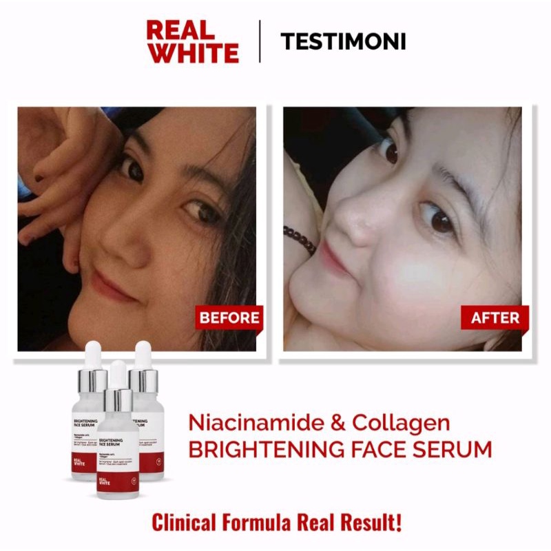 REAL WHITE Niacinamide + Collagen Brightening Face Serum 20ml