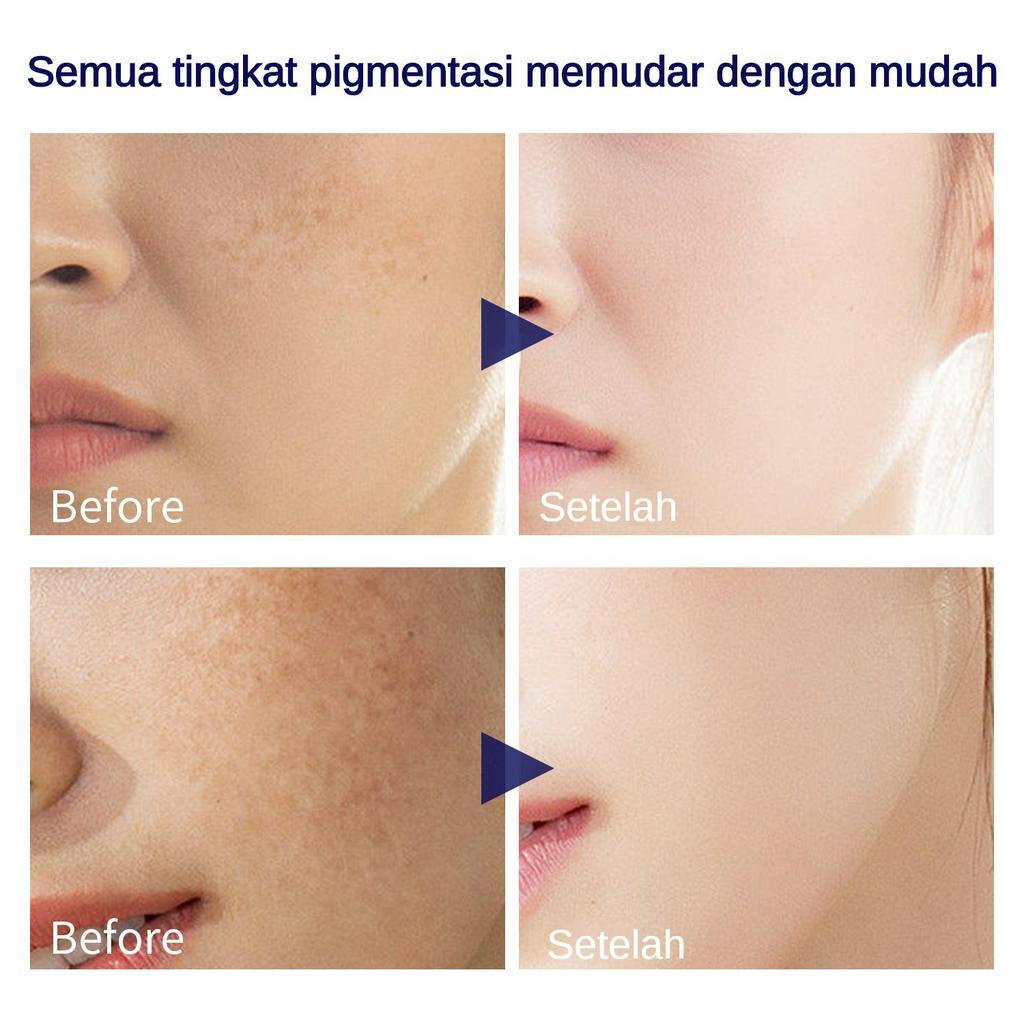 YOUBUY Dark Spots Whitening Face Serum 30ml Hyaluronic Serum Niacinamide Serum Pencerah Wajah Essence