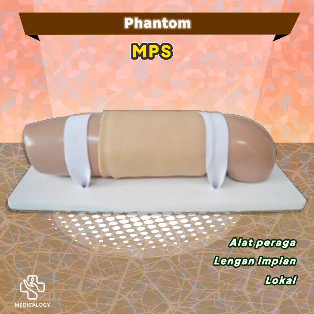 Phantom Lengan Implan