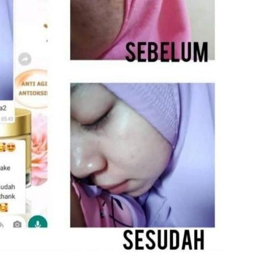 [PROMO] CLEORA BEAUTY JELLY BOOSTER ORIGINAL