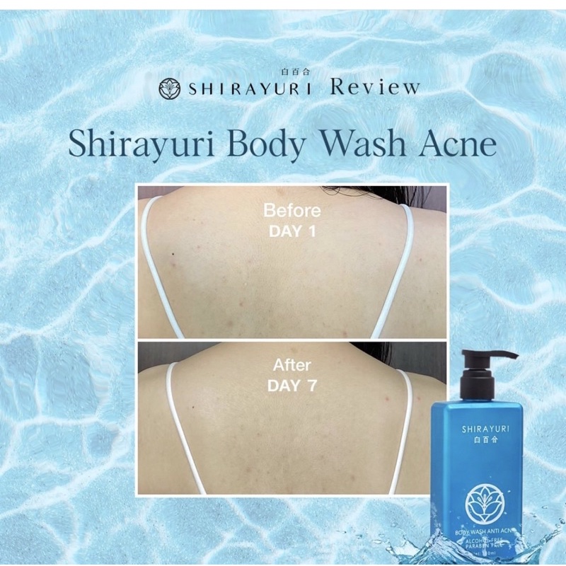 SHIRAYURI SHAMPOO ANTI HAIR FALL