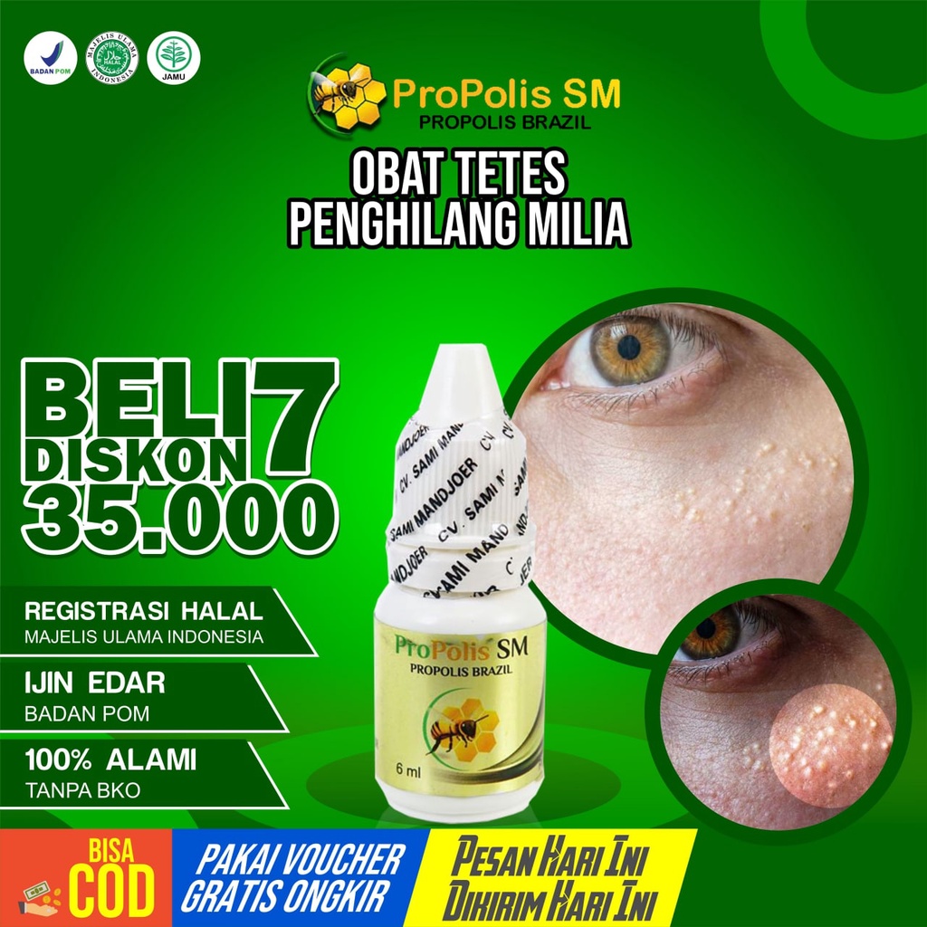 Obat Milia - Obat Tetes Penghilang Milia DIwajah Bawah Mata - Propolis SM