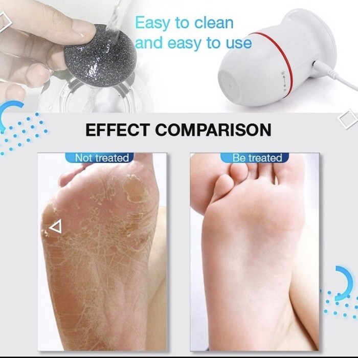 Electric Foot Grinder 2.0 Original / Alat Penghalus Tumit Kaki kapalan