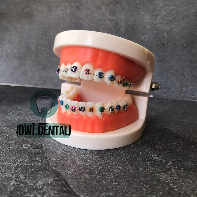 Dental model study gigi bening model studi gigi brace rahang gigi