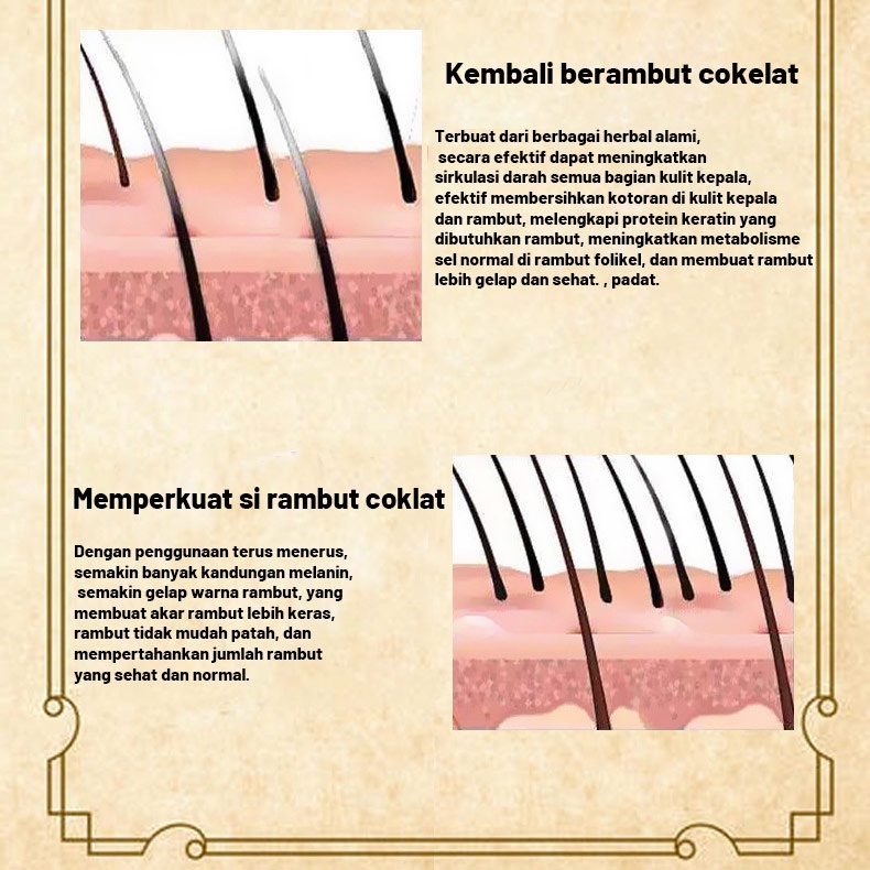 Pertumbuhan rambut Kondisioner fo-ti/Merawat rambut Serum Memperbaiki folikel rambut Cepat menumbuhkan rambut/Cairan jahe penumbuh rambut Rambut putih cepat menghitam Anti rambut rontok pria dan wanita