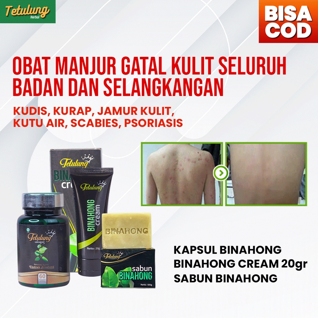 PAKET HEMAT MURAH OBAT LUKA DAN GATAL KAPSUL , CREAM 20gr DAN SABUN BINAHONG BPOM