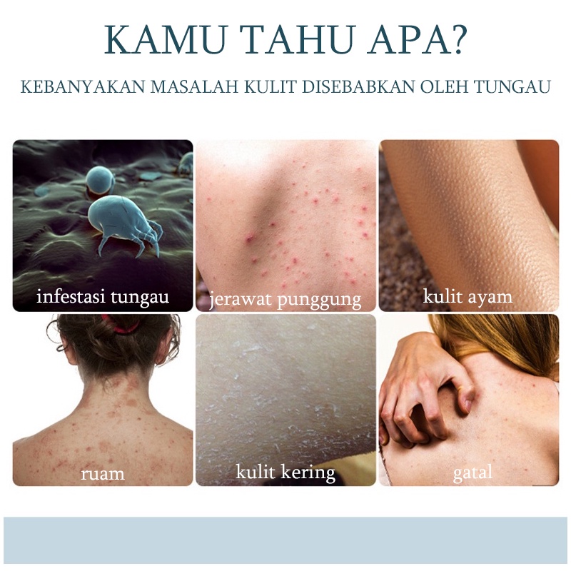 Gel mandi Sabun mandi jerawat cair pemutih badan Acne body wash Whitening body wash Menghilangkan tungau dan jerawat Pemutih kulit Banyak nutrisi Pembersihan lembut Mengangkat kotoran kulit dan sel kulit mati