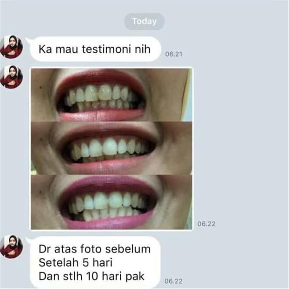 Pemutih Gigi Alami ORIGINAL Teeth Whitening Charcoal Powder Arang Bubuk Senyum Cantik