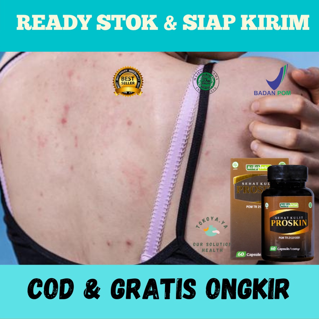 PROSKIN, Obat Penghilang Bruntusan di Punggung, Obat Penghilang Jerawat Punggung, Obat Jerawat Pungg