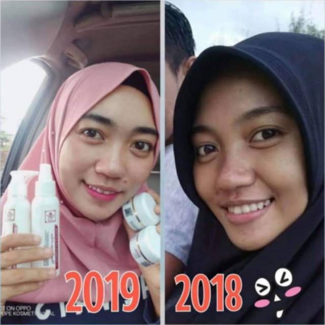 RK GLOW SKINCARE PAKET ACNE ORIGINAL