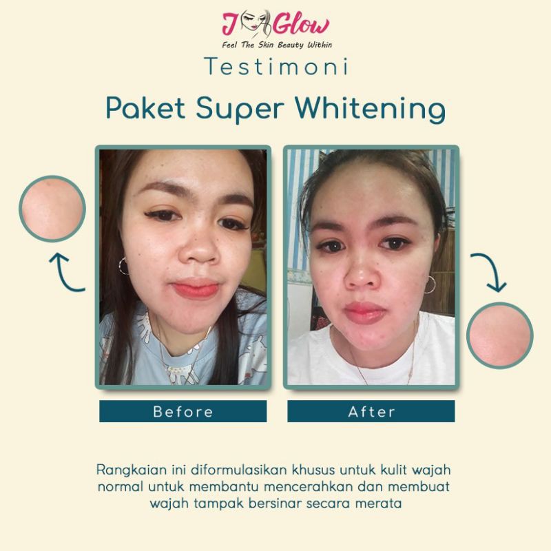 JGLOW PAKET SUPER WHITENING CREAM GLOWING/SKINCARE BPOM PERAWATAN WAJAH-2