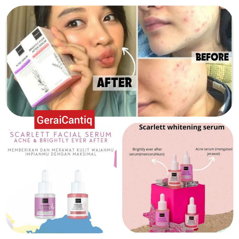 SCARLETT WHITENING SERUM ORIGINAL PEMUTIH WAJAH GLOWING