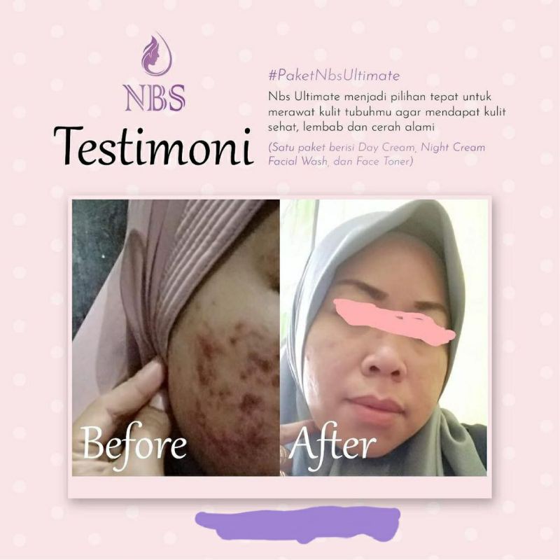 NBS SKINCARE ULTIMATE NEW-2