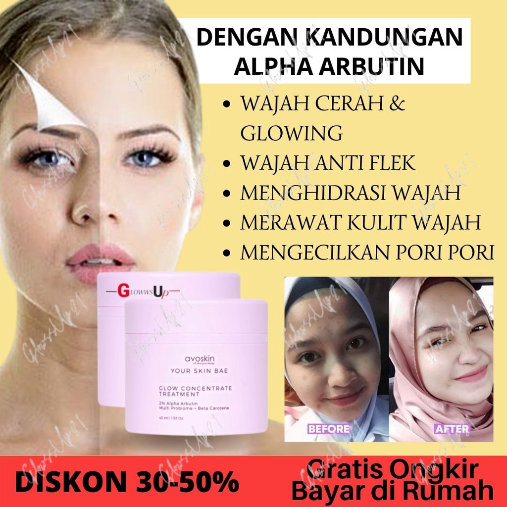 Pelembab Wajah Avoskin YSB Glow Concentrate 2% Alpha Arbutin+Microbiome+Beta Carotene Treatment Wajah