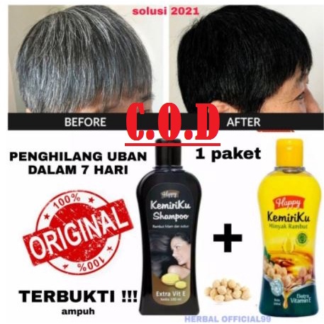 TERBARU*PENGHILANG UBAN DAN PENUMBUH RAMBUT-PAKET SHAMPO &amp; MINYAK KEMIRIKU  100% ORIGINAL BPOM NEWS-EXP.2025