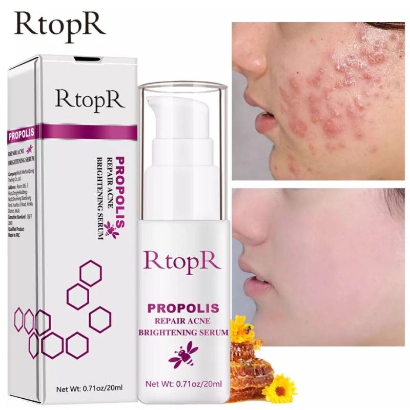 rtopr propolis repair acne brightening serum jerawat memudarkan noda hitam bekas jerawat