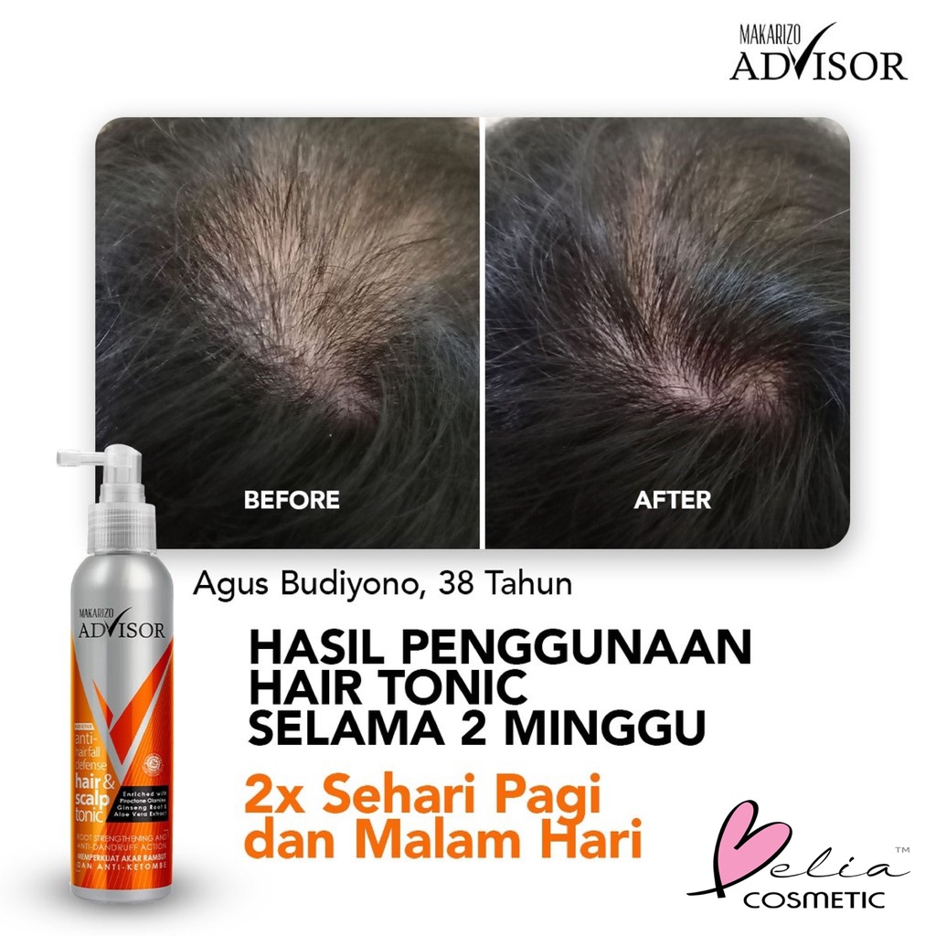 ❤ BELIA ❤ MAKARIZO Advisor Hair &amp; Scalp Tonic 145mL &amp; 65ml | Perawatan Rambut Rontok dan Ketombe (BPOM)