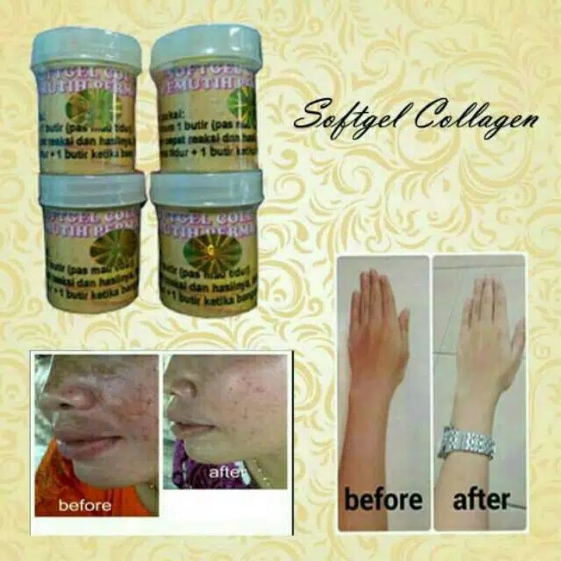 Softgel Collagen Suplemen Pemutih