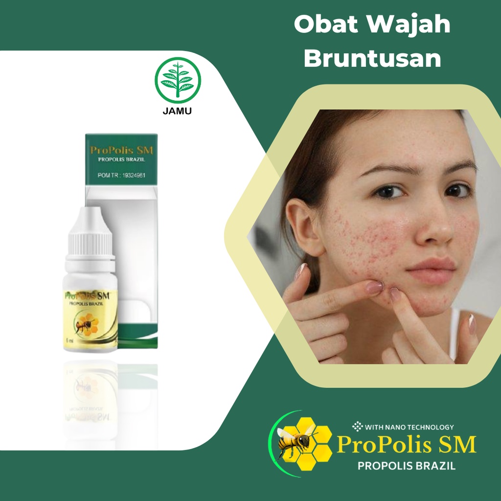 Obat Wajah Bruntusan, Bruntusan di Jidat, Bruntusan di Wajah, Bruntusan di Punggung, Pantat Bruntusa