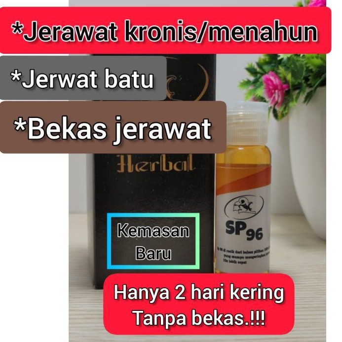 OBAT JERAWAT BATU AMPUH.!!!