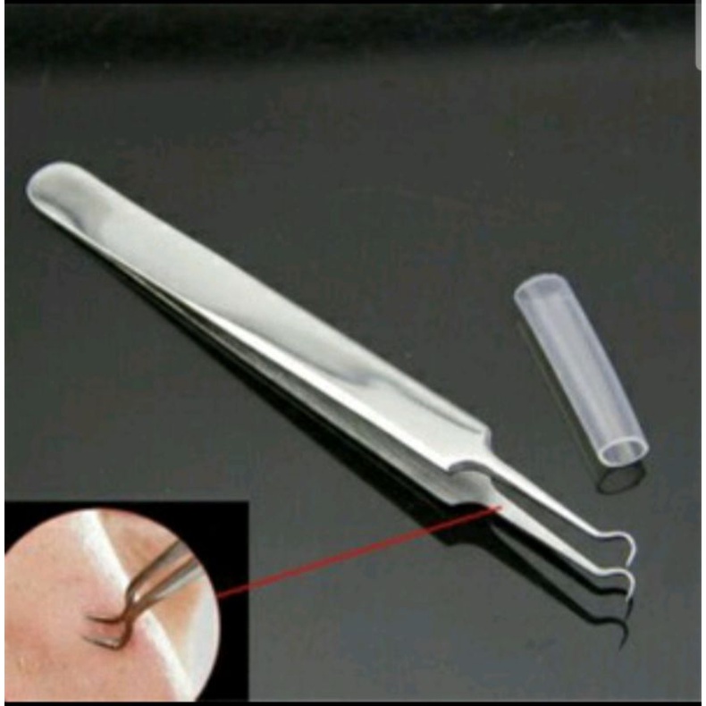 Pinset Komedo/ Penjepit Komedo/ Blackhead Tweezer