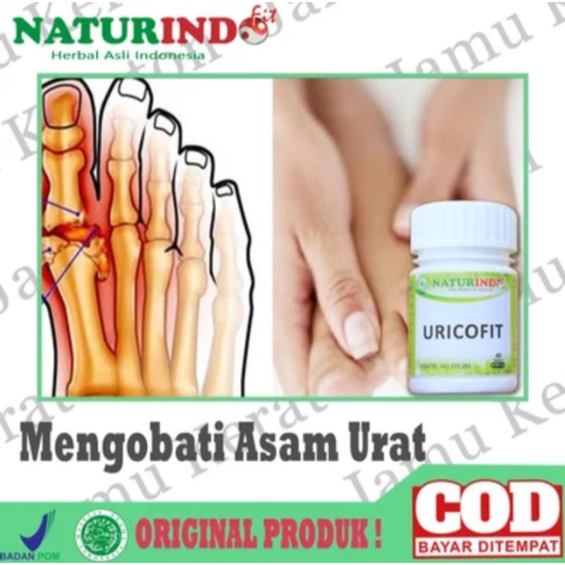 OBAT ASAM URAT NYERI SENDI ATASI ASAM URAT PALING AMPUH