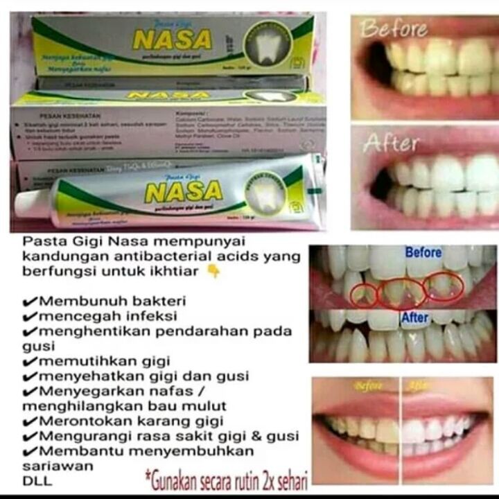 [ORI] PASTA GIGI ANTI BAKTERI MULUT DAN GUSI 24 JAM MELINDUNGI | NASA COMPLETE MOUTH CARE