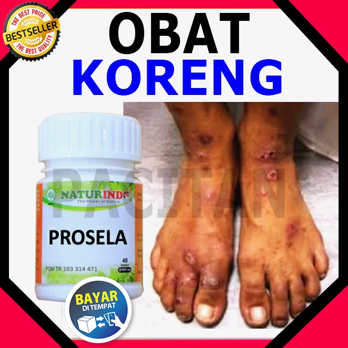 Obat Koreng Korengan Korengen Borok Luka Bernanah Ulkus Tropikum  Paling Ampuh Herbal NATURINDO COD