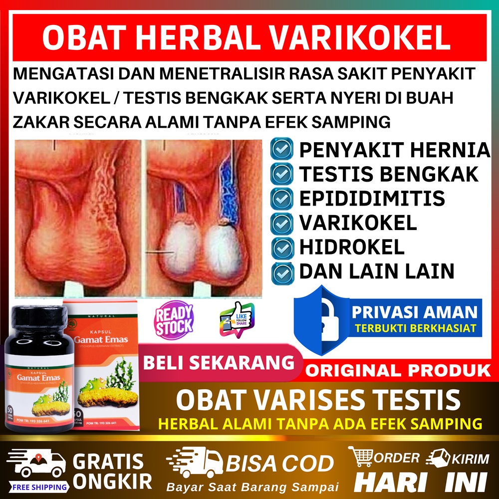 Obat Varikokel Buah Zakar Bengkak Sebelah Varises Testis Bengkak Mandul Nyeri Biji Pelir Urat testis