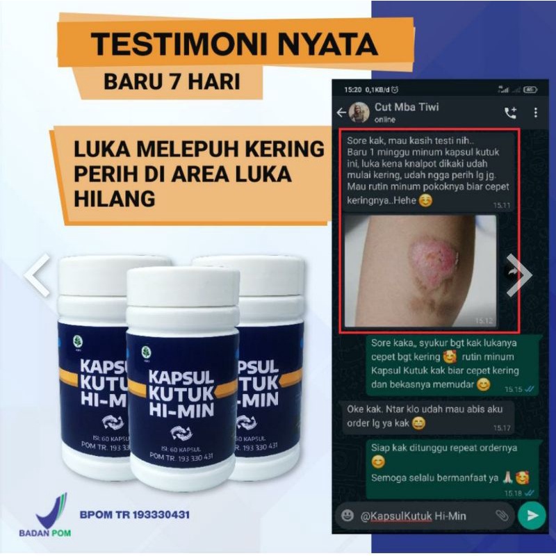 KAPSUL KUTUK HI-MIN EKSTRAK IKAN GABUS ALBUMIN OBAT PENGERING LUKA PASCA OPERASI HERBAL ALAMI (BK)