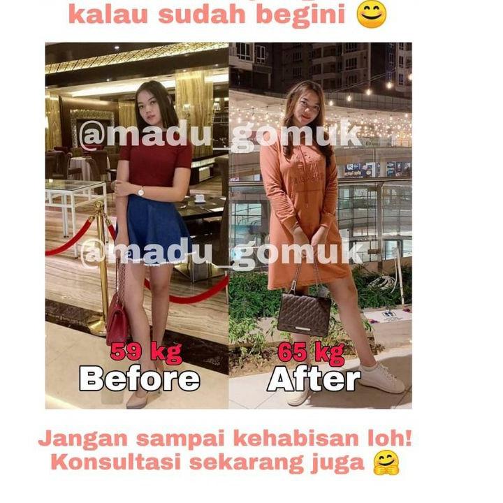 

Ready Stok PZZNL GOMUK MADU PENGGEMUK/ 100% ORIGINAL/NAIK 5-10 KG/ATASI GEMUK KETURUNAN/KURUS CACINGAN 53 Ready stock