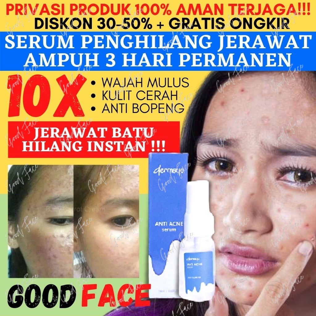 SERUM ACNE - DERMAYU SERUM ANTI ACNE - SERUM JERAWAT - PENGHILANG JERAWAT - SKINCARE WAJAH