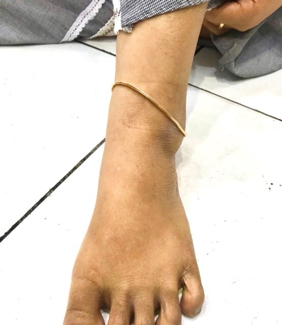 Gelang kaki wanita gelang kaki penggati emas gelang kaki milano