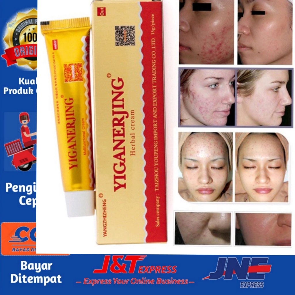 [BISA COD] Salep Yiganerjing | Cream Yiganerjing 15Gram | Salep Eksim Jamur Psoriasis Dermatitis | Salep Herbal