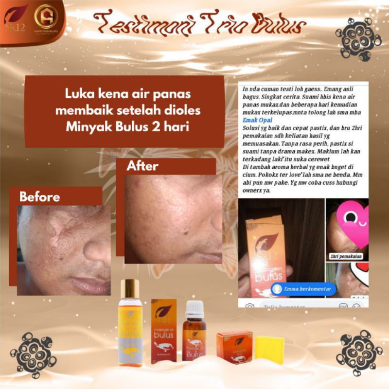 MINYAK BULUS SR12 / PAKET AMPUH / MASSAGE OIL BULUS BPOM / TREATMENT WAJAH DAN TUBUH