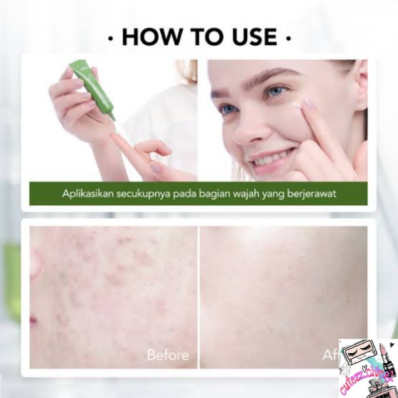 ☃️Cutezz_Ching1☃️YOu Acne Plus Triple Action Spot Care 15g