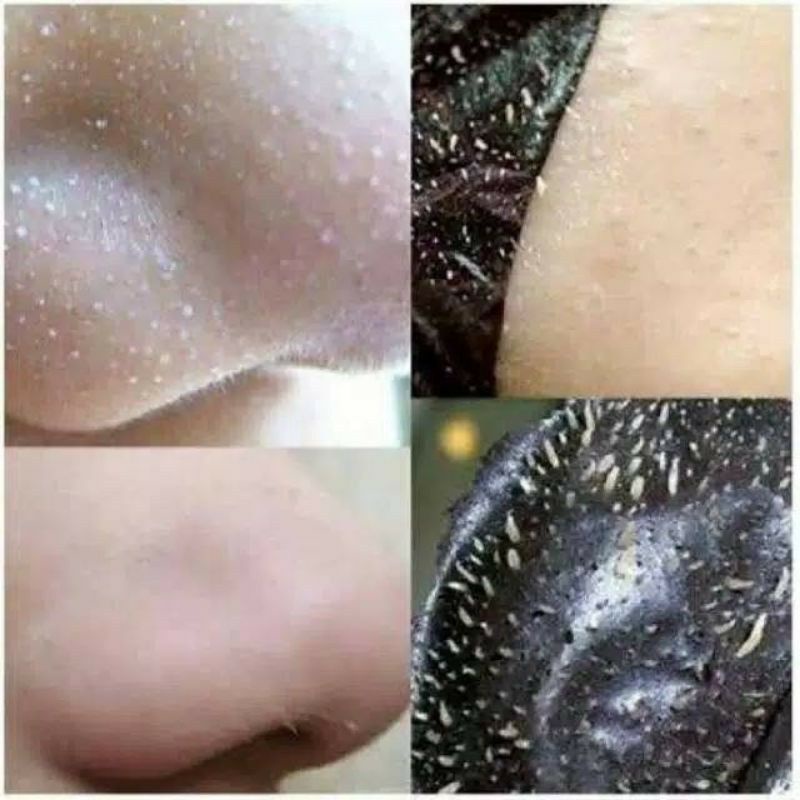 MASKER KOMEDO AMPUH ATASI KOMEDO