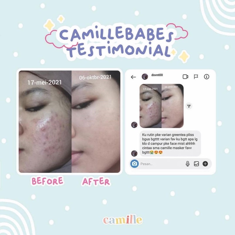 CAMILLE BEAUTY MASKER WAJAH CAMILE BEAUTE MASK MASKER CAMELIA CAMMILE CEMILE CEMILLE BEAUTY PINKROULETTE DAISY ORGANIC OHMYSKIN LITTLE POP FACE MIST FACEMIST