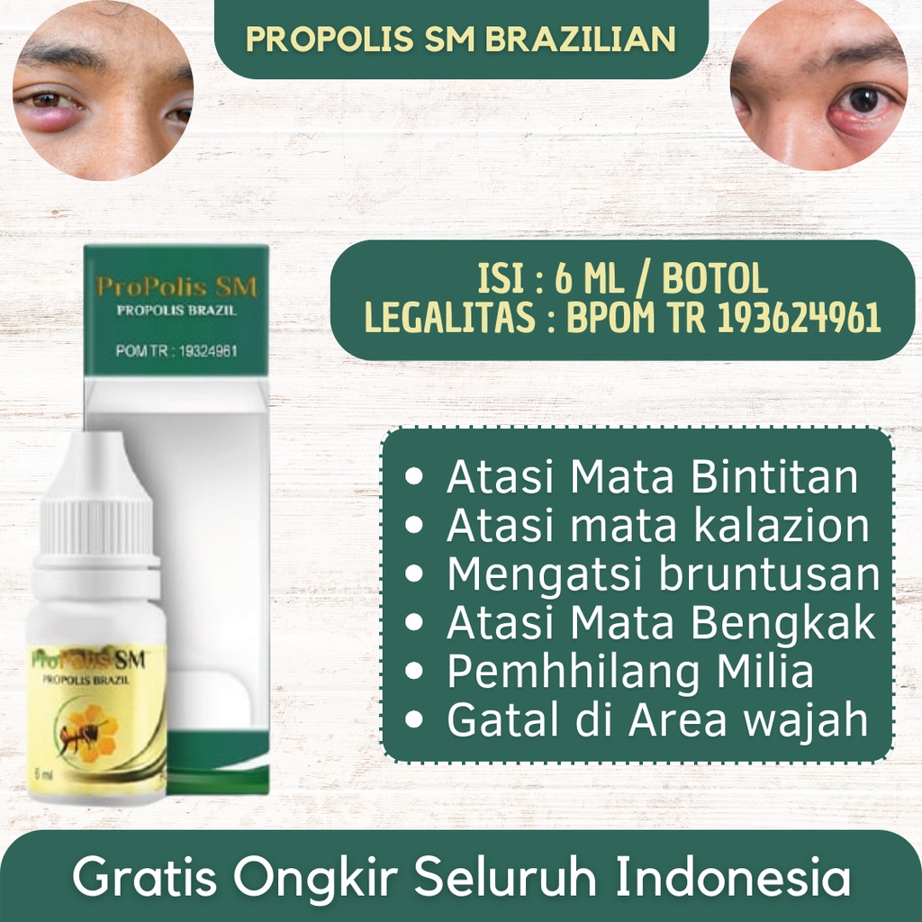 Jual Bisa COD - Obat Bintitan - Mata Bintitan, Mata Kalazion, Benjolan ...