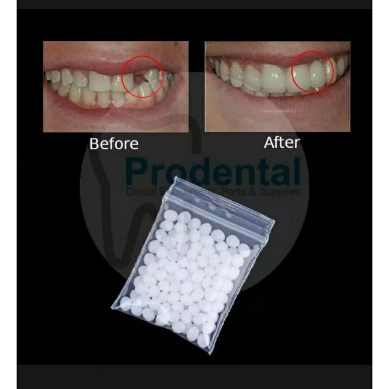 gigi palsu temptooth