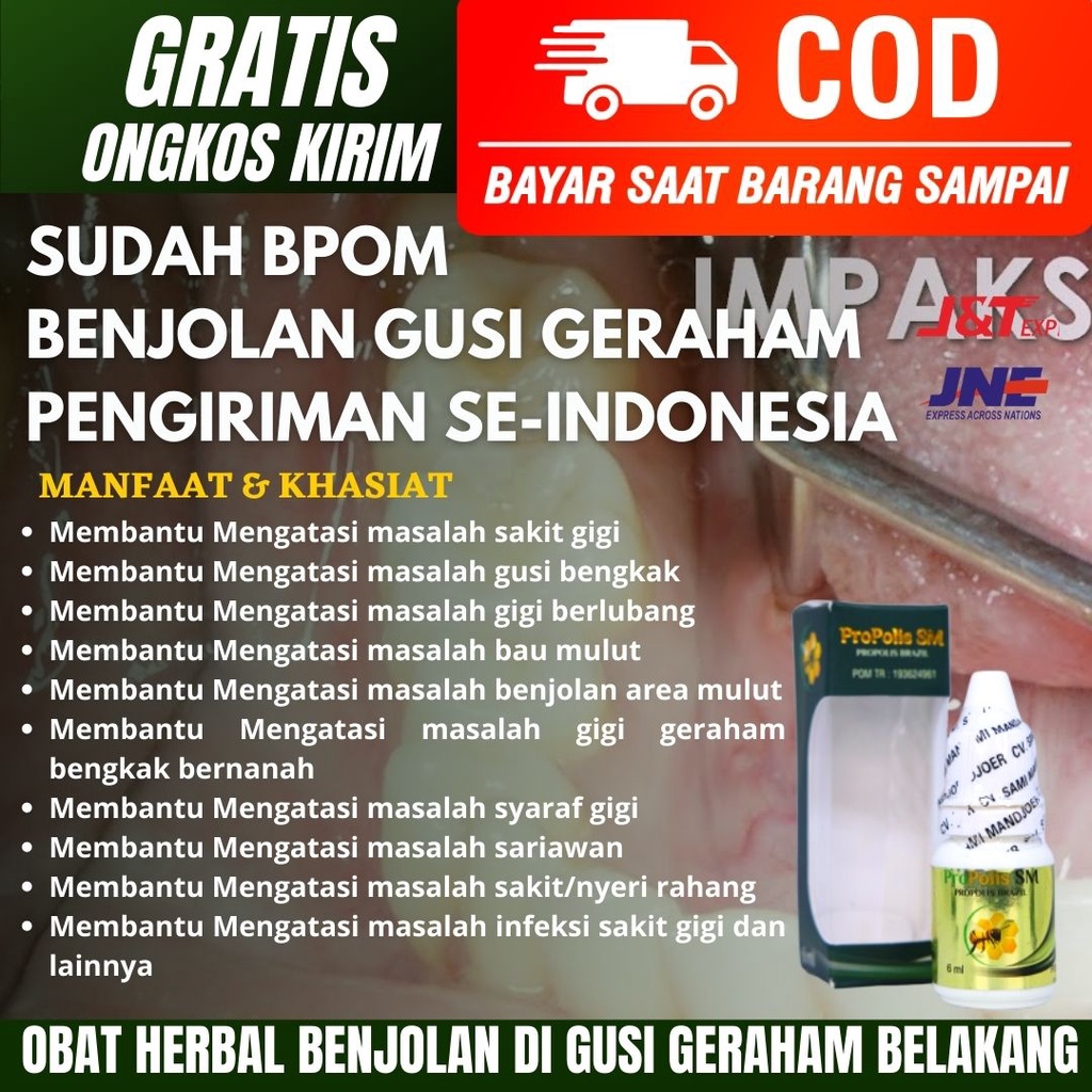 Obat Benjolan Di Gusi Geraham Belakang-Sakit Gigi Geraham-Benjolan Bernanah-Gusi Bernanah
