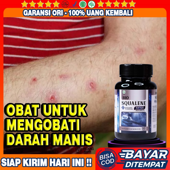 Obat Darah Manis - Obat Kulit Gatal-gatal - Obat Gatal Amis Daging - Obat Koreng Di Kaki - Obat Prur