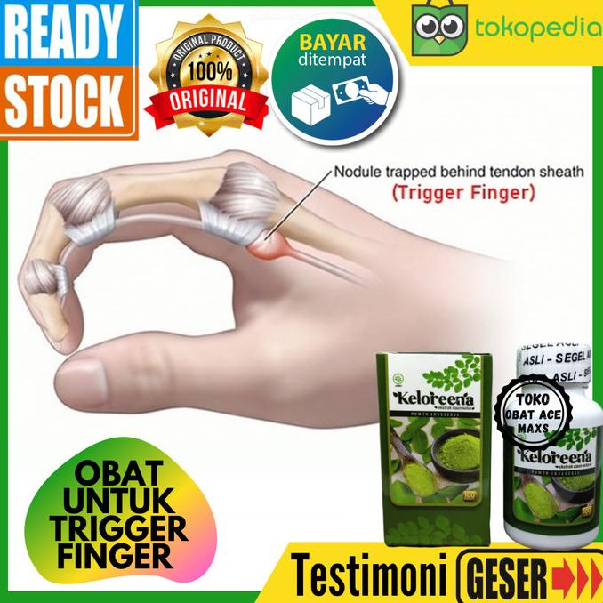 Obat Trigger Finger, Obat Bells Palsy, Obat CTS Carpal Tunnel Syndrome