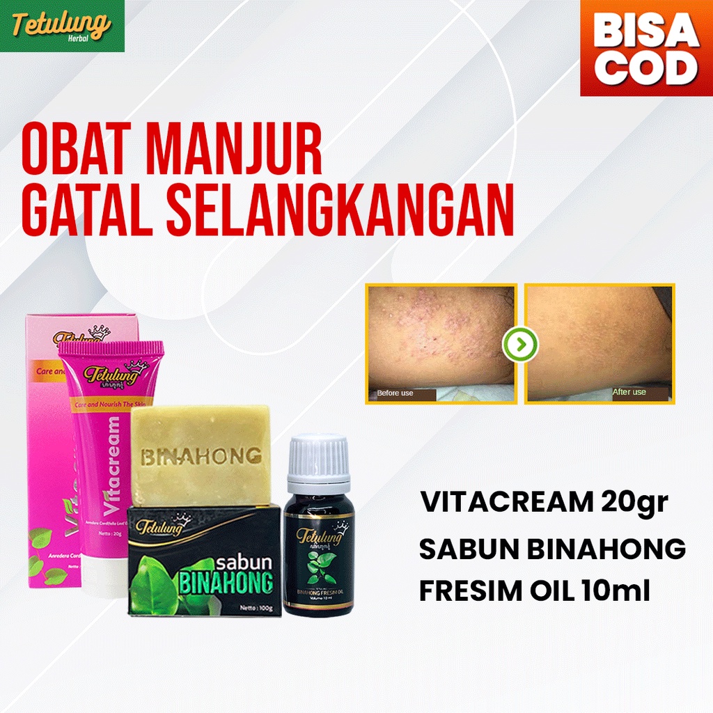 Paket Obat Salep Gatal Selangkangan Eksim Menahun Ampuh - Vitacream , Sabun Binahong &amp; Binahong Fresim Oil BPOM