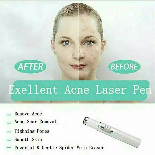 Laser penghilang kutil alat kecantikan murah agar wajah bersih