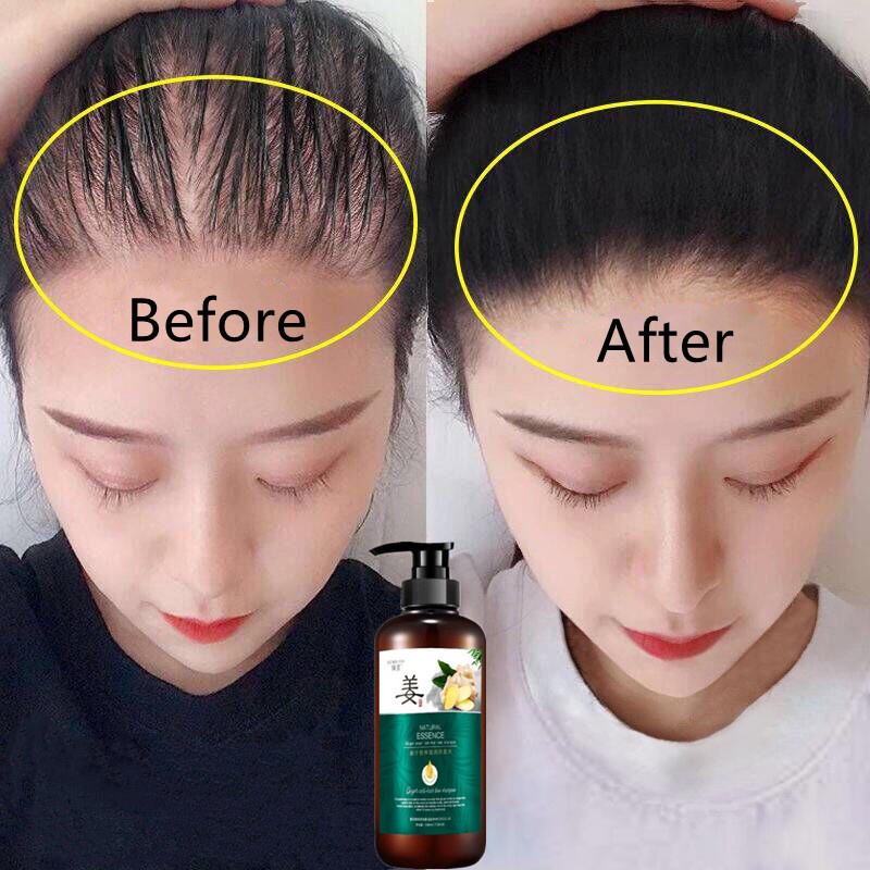 Shampo Penumbuh Rambut Shampo Anti Rambut Rontok 500ml Jahe Mempercepat Pertumbuhan Rambut Mencegah Rambut Rontok Anti Ketombe Dan Gatal-Gatal