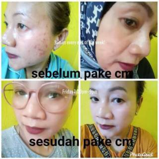SEPAKET CREAM CM CUCOK CREAM MEONG KRIM IMELDA YUNUS KOSMETIK krim CM CUCO MEONG PERAWATAN SKINCARE