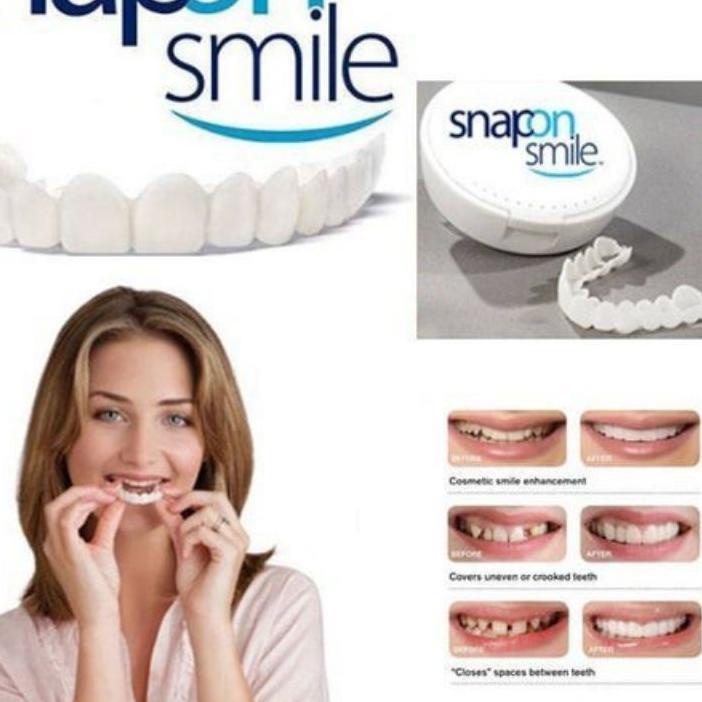 Hot - Snap On Smile 100% ORIGINAL Authentic  Snap n Smile Gigi Palsu