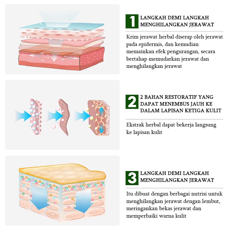 Serum Cream penghilang jerawat Gel Perawatan jerawat Cream untuk jerawat 30g Memperbaiki Menenangkan dan memperbaiki jerawat Kulit berjerawat Kulit halus Lembut dan tembus pandang