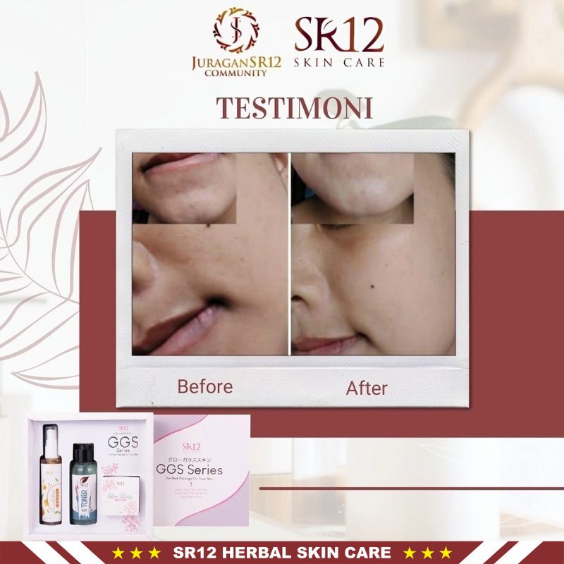 GGS SR12 | GGS Series SR12 Skincare | Glow Glass Skin Gel | Paket Perawatan &amp; Kecantikan